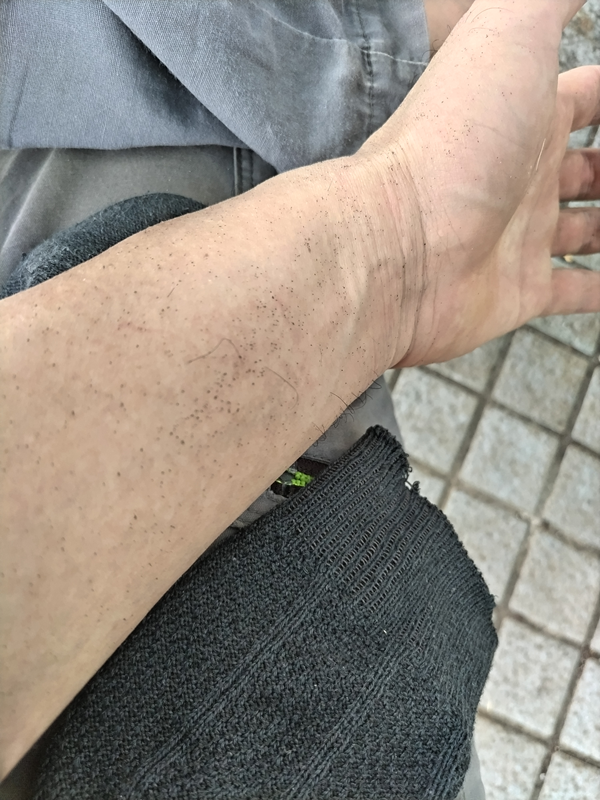 ニートひきこもりを脱して働き出した初日の昼休みにて、砂塗れになった腕の様子