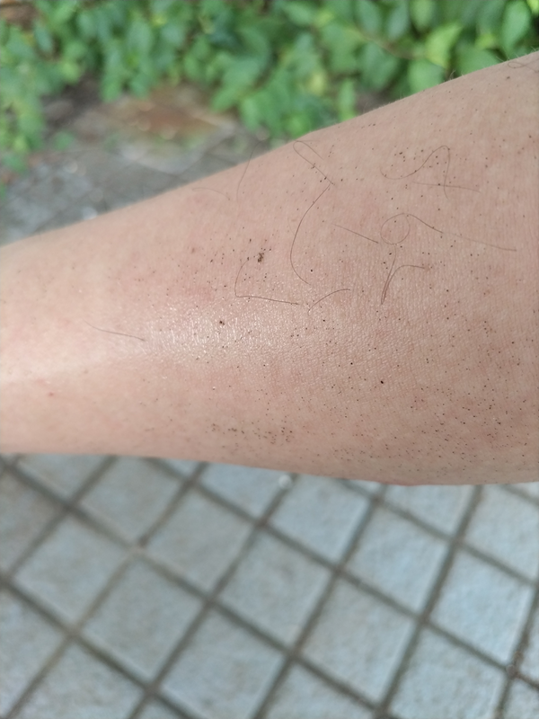 ニートひきこもりを辞めて働き出した初日の腕