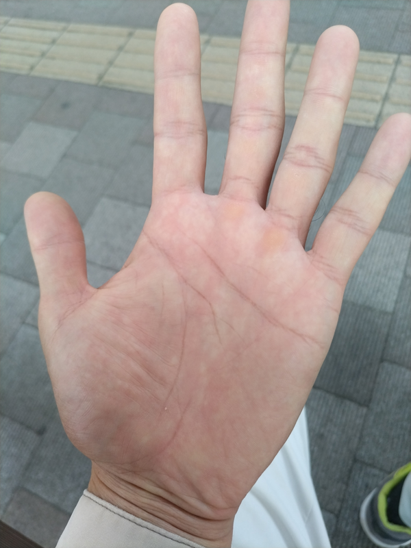 元引籠りの左手の掌