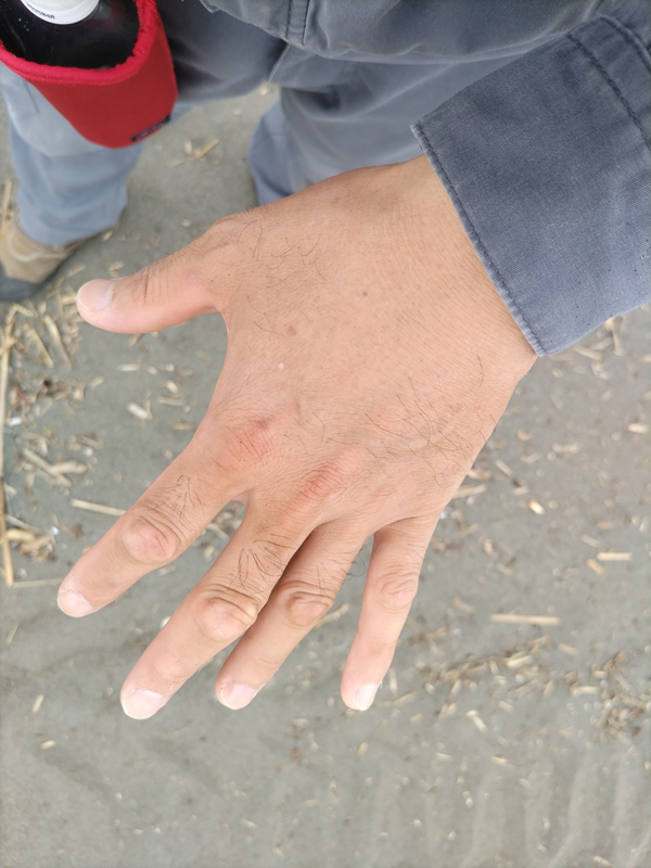 元引籠りの齋藤健一の左手の手の甲と鼠色の作業服の袖