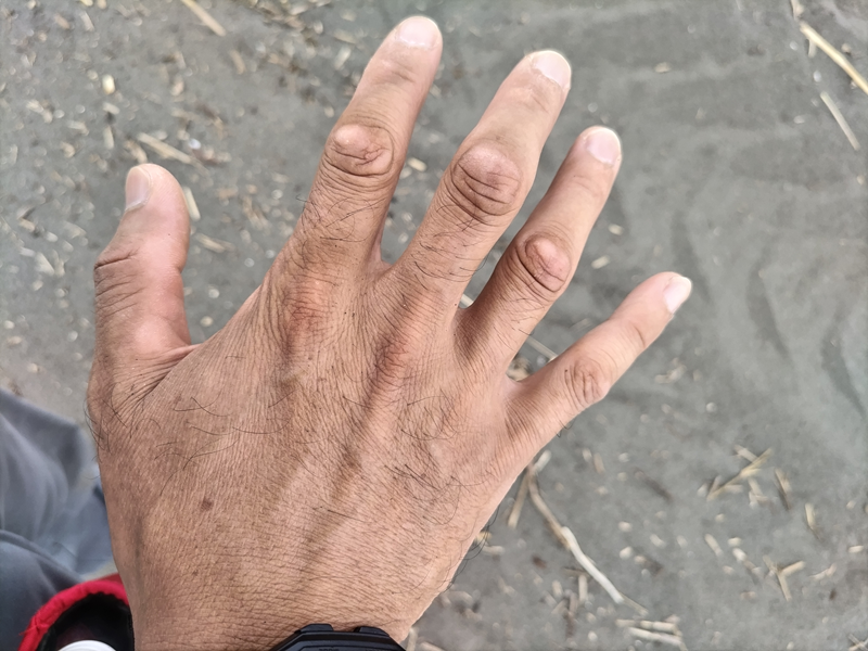 元ニート引籠りの俺が見ていた右手の手の甲が日焼けしている様子【辻堂海岸】