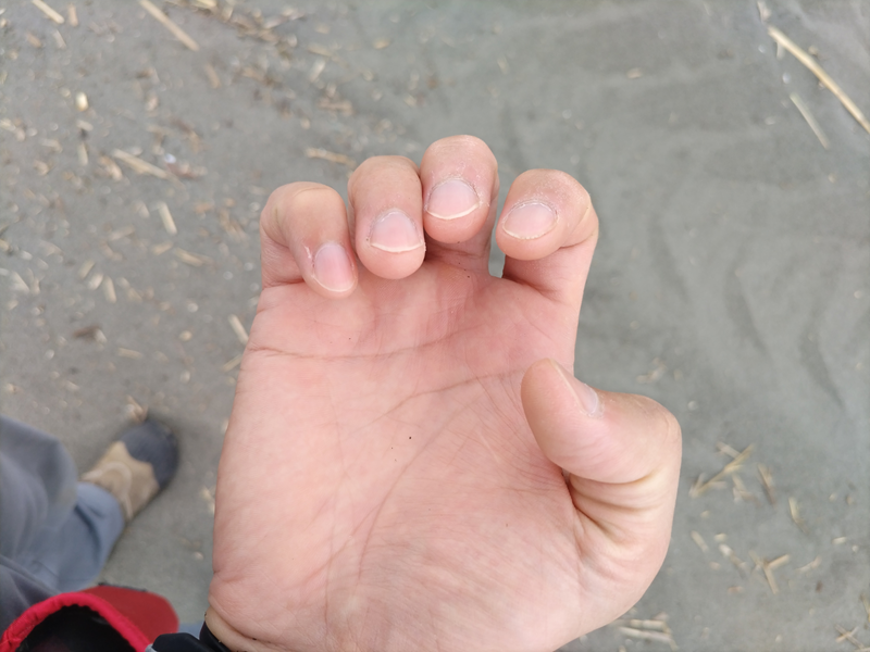 元ニート引籠りの俺が見せた右手の爪