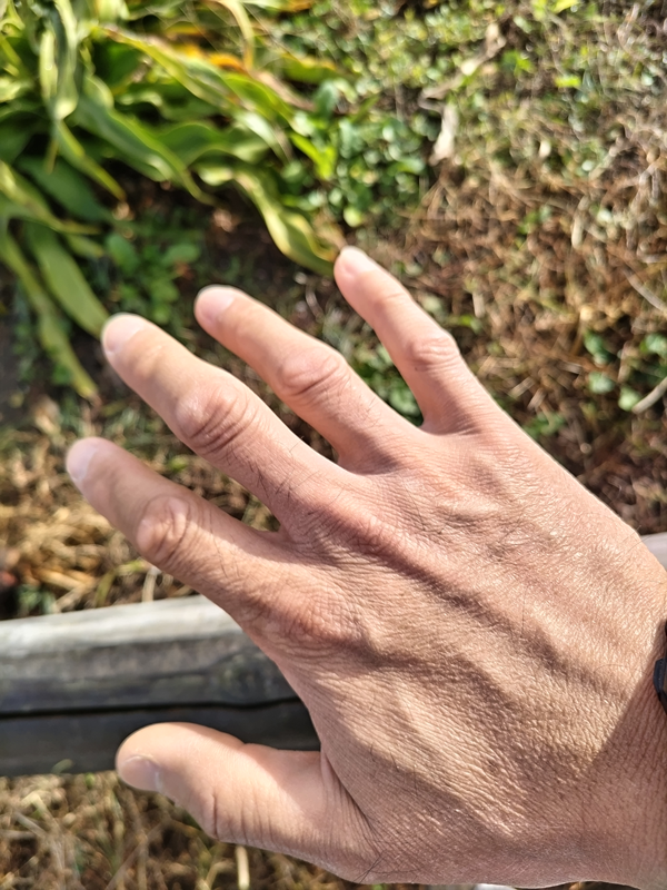 元ニート引籠りの齋藤健一が開いていた右手の手の甲に日光が当たっているところ