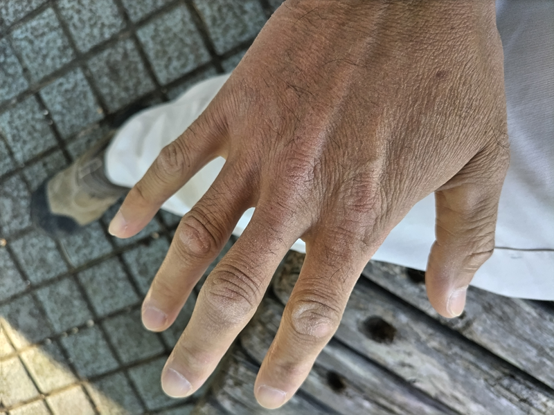 元ニートのセル齋藤が右手の手の甲を見ている様子