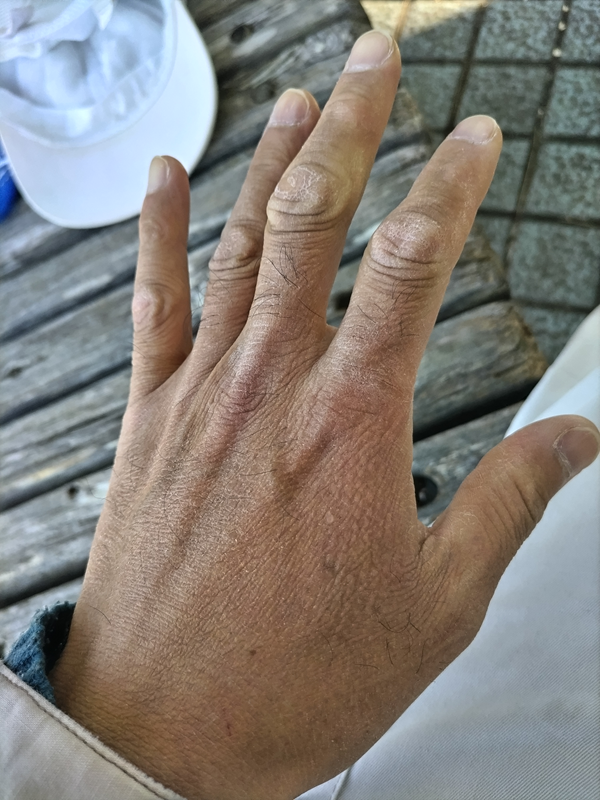 元引籠りニートのセル齋藤が開いていた左手の手の甲